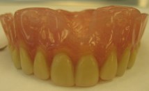 Dentures